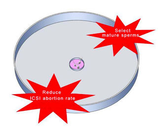 Hyaluronic Acid Lựa chọn tinh trùng Dish Đối với ICSI IVF Giảm tỷ lệ mất thai