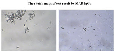 SpermFunc Bộ xét nghiệm sinh sản nam để xác định IgG kháng thể lớp phủ Spermatozoa