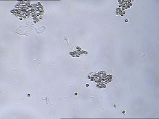 Bộ xét nghiệm MAR IgA Bộ kiểm tra kháng thể IgA Lớp phủ kháng thể Spermatozoa MAR Bộ xét nghiệm chức năng của tinh trùng