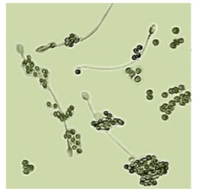 BRED-011 Bộ xét nghiệm sinh sản nam để xác định Spermatozoa Chẩn đoán vô sinh nam