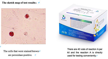 Bộ xét nghiệm bạch cầu tinh dịch Peroxidase Staining 40T/Kit Bộ xét nghiệm chức năng tinh trùng