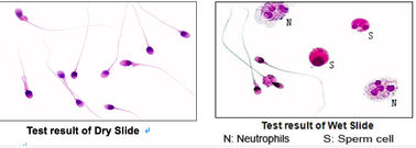 Kiểm tra hình thái tế bào máu Trang trình bày nhuộm màu trước