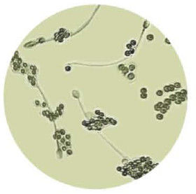 Anti Sperm Antibody IgG Test Kit MAR AsAb For Immunological Infertility